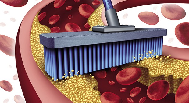 La prevenzione cardiovascolare